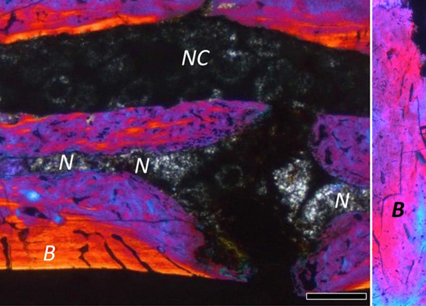 intervertebral disc 1