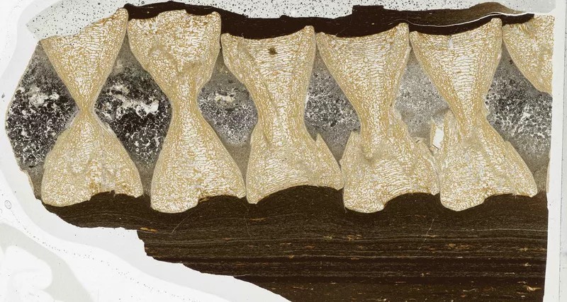 vertebral anatomy 1